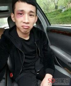 mc天佑被打照片,网络暴力下的明星遭遇